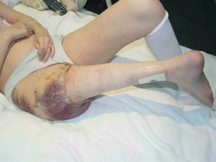 57 Fascinating And Unnerving Medical Pics You May Need A Minute To Process (New Pics)