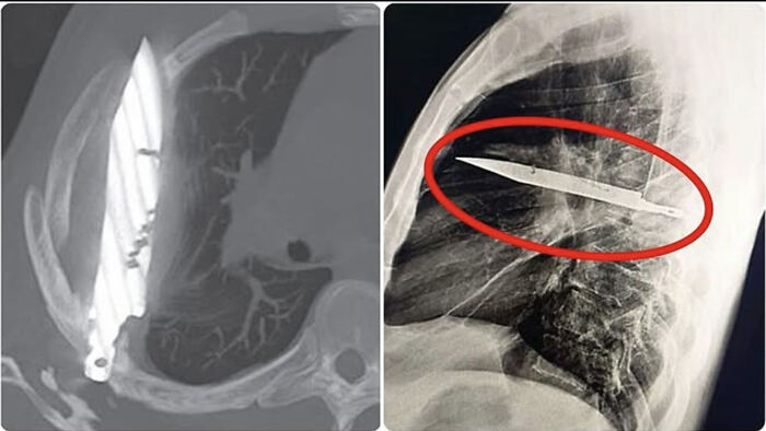 57 Fascinating And Unnerving Medical Pics You May Need A Minute To Process (New Pics)