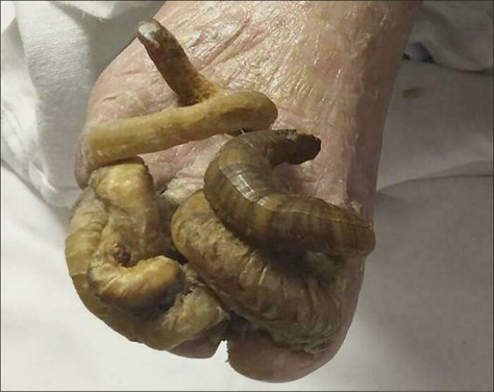 57 Fascinating And Unnerving Medical Pics You May Need A Minute To Process (New Pics)