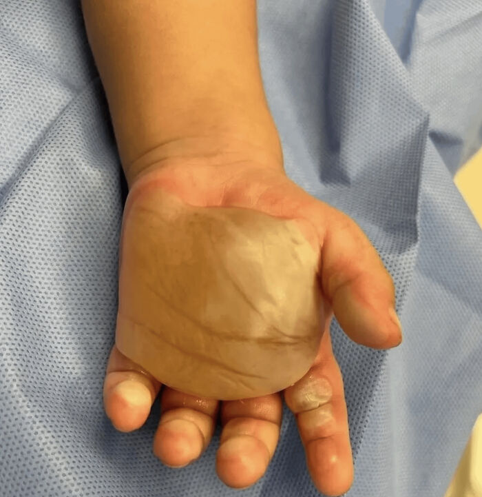 57 Fascinating And Unnerving Medical Pics You May Need A Minute To Process (New Pics)
