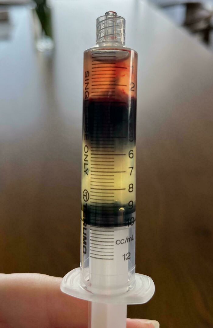 57 Fascinating And Unnerving Medical Pics You May Need A Minute To Process (New Pics)