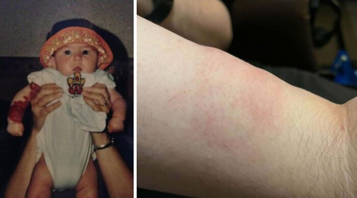 57 Fascinating And Unnerving Medical Pics You May Need A Minute To Process (New Pics)