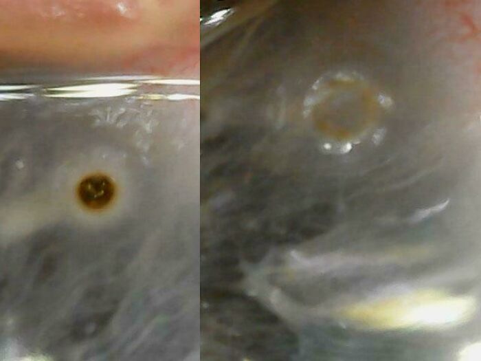 57 Fascinating And Unnerving Medical Pics You May Need A Minute To Process (New Pics)