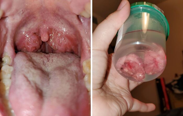 57 Fascinating And Unnerving Medical Pics You May Need A Minute To Process (New Pics)