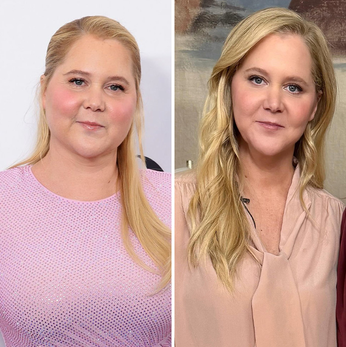 Amy Schumer Trolls Herself Shortly After Divorce Filing Amid Backlash Over Bikini Photos