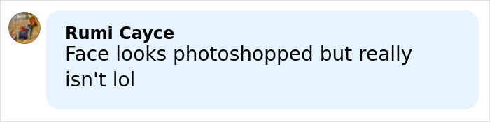 Amy Schumer Trolls Herself Shortly After Divorce Filing Amid Backlash Over Bikini Photos