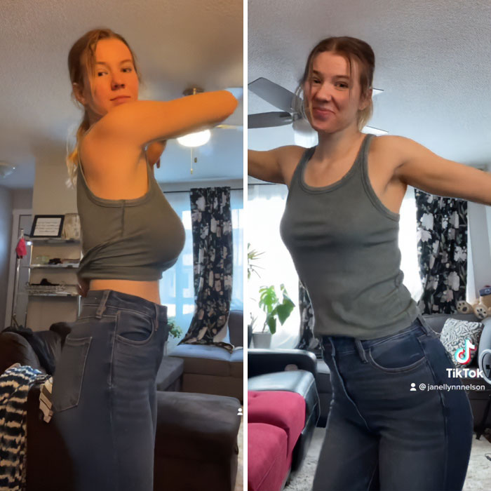 “The Real Tragedy Of 2026”: Woman Viciously Trolled By Men After Going Viral For Breast Reduction “The Real Tragedy Of 2026”: Woman Viciously Trolled By Men After Going Viral For Breast Reduction