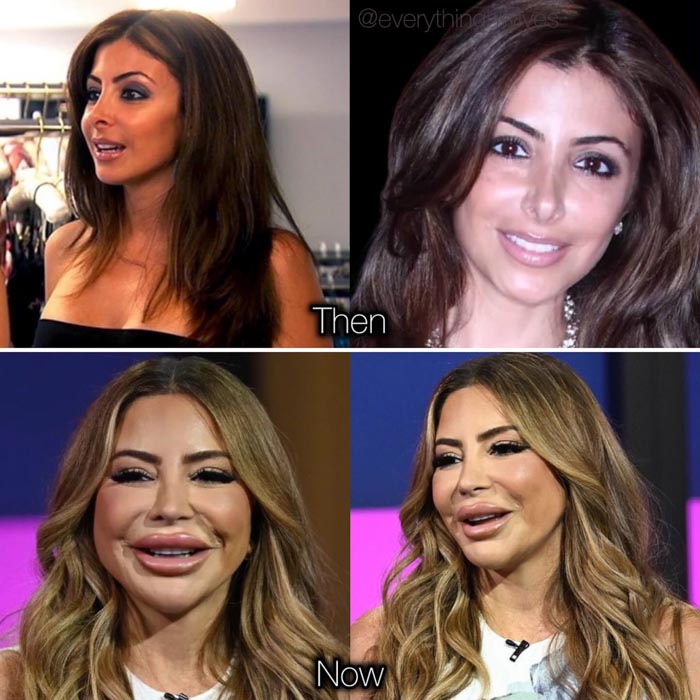 Then And Now: Larsa Pippen Plastic Surgery Transformation