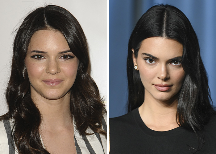 “She Just Looks Plastic”: Kendall Jenner Slammed After Claiming She&rsquo;s Never Had Any Surgery