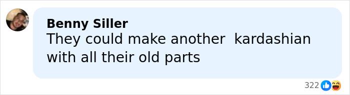 “She Just Looks Plastic”: Kendall Jenner Slammed After Claiming She&rsquo;s Never Had Any Surgery