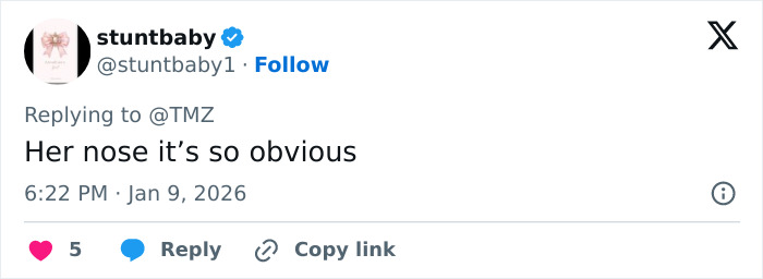 “She Just Looks Plastic”: Kendall Jenner Slammed After Claiming She&rsquo;s Never Had Any Surgery