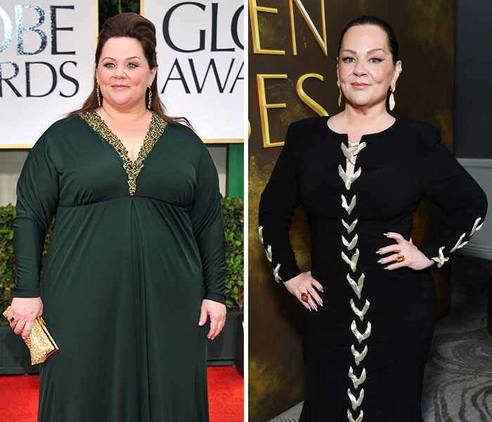 10 Stars Whose Dramatic Transformations Stunned Fans At The 2026 Golden Globes