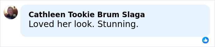 &ldquo;The Botox Gets Hard&rdquo;: Kylie Jenner&rsquo;s Beauty Hack For The Golden Globes Sparks Wild Reactions