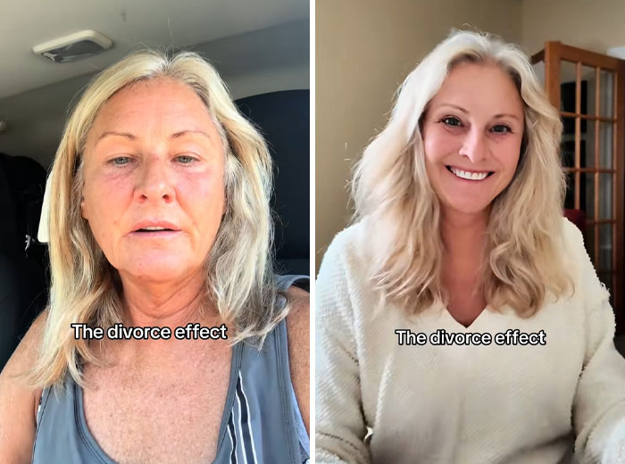 43 Before And After Pics That Prove Getting Divorced Is Sometimes The Best Makeover You&rsquo;ll Ever Have