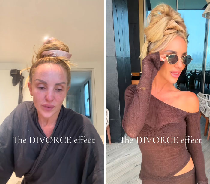43 Before And After Pics That Prove Getting Divorced Is Sometimes The Best Makeover You&rsquo;ll Ever Have