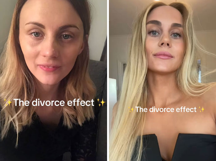 43 Before And After Pics That Prove Getting Divorced Is Sometimes The Best Makeover You&rsquo;ll Ever Have
