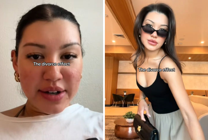 43 Before And After Pics That Prove Getting Divorced Is Sometimes The Best Makeover You&rsquo;ll Ever Have