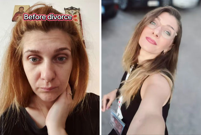 43 Before And After Pics That Prove Getting Divorced Is Sometimes The Best Makeover You&rsquo;ll Ever Have