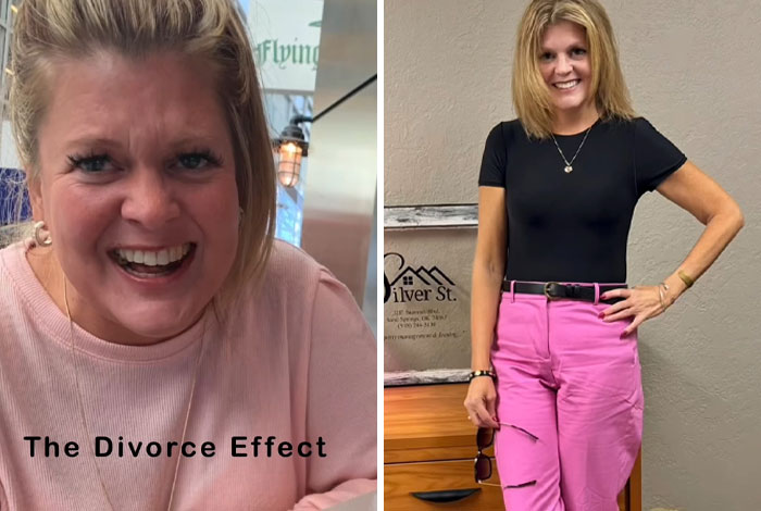 43 Before And After Pics That Prove Getting Divorced Is Sometimes The Best Makeover You&rsquo;ll Ever Have