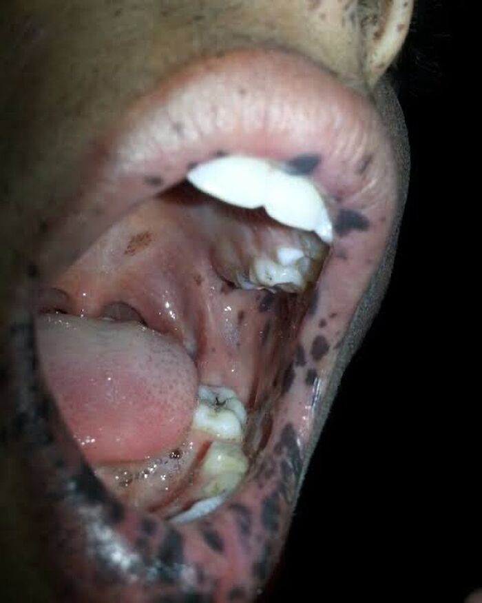 80 Fascinating And Unnerving Medical Pics You May Need A Moment To Process