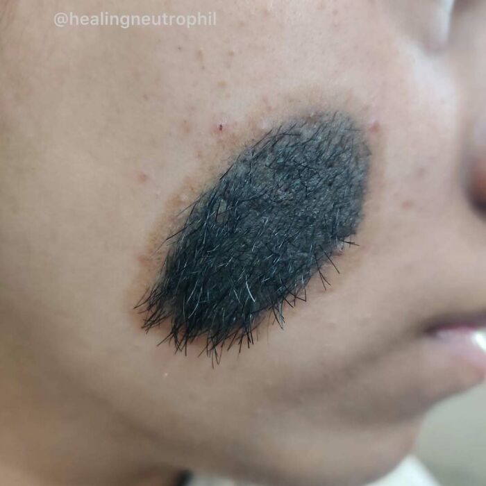 80 Fascinating And Unnerving Medical Pics You May Need A Moment To Process