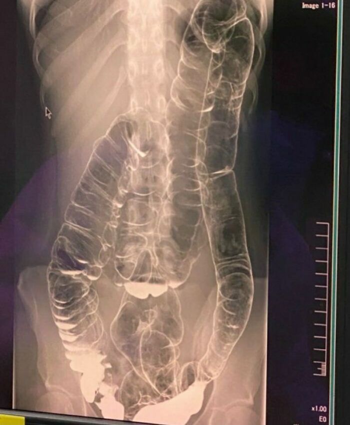 80 Fascinating And Unnerving Medical Pics You May Need A Moment To Process