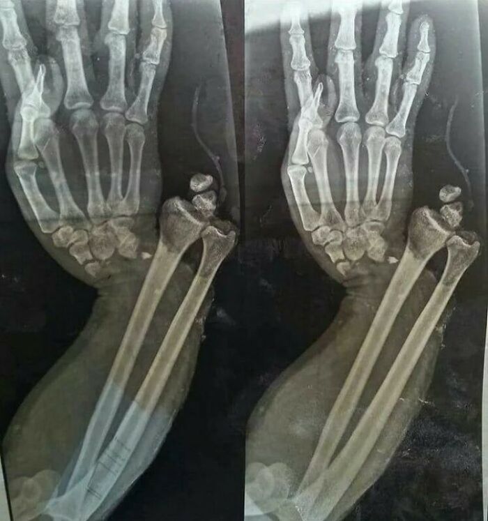 80 Fascinating And Unnerving Medical Pics You May Need A Moment To Process