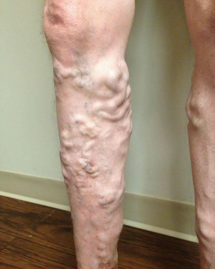 80 Fascinating And Unnerving Medical Pics You May Need A Moment To Process