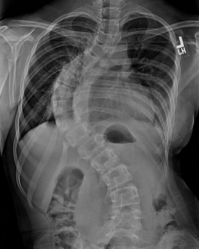 80 Fascinating And Unnerving Medical Pics You May Need A Moment To Process