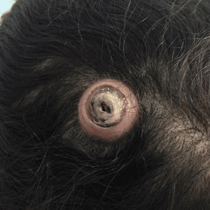 80 Fascinating And Unnerving Medical Pics You May Need A Moment To Process