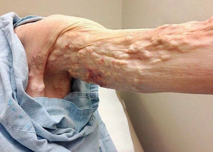 80 Fascinating And Unnerving Medical Pics You May Need A Moment To Process