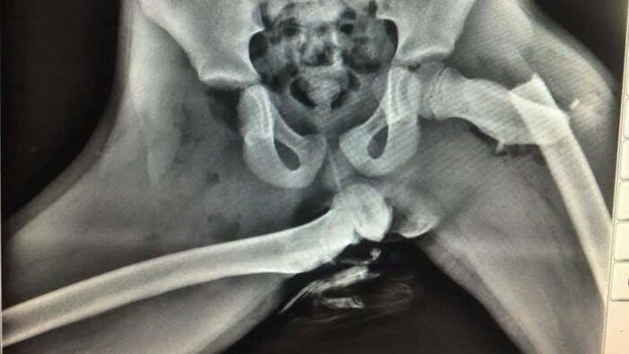 80 Fascinating And Unnerving Medical Pics You May Need A Moment To Process