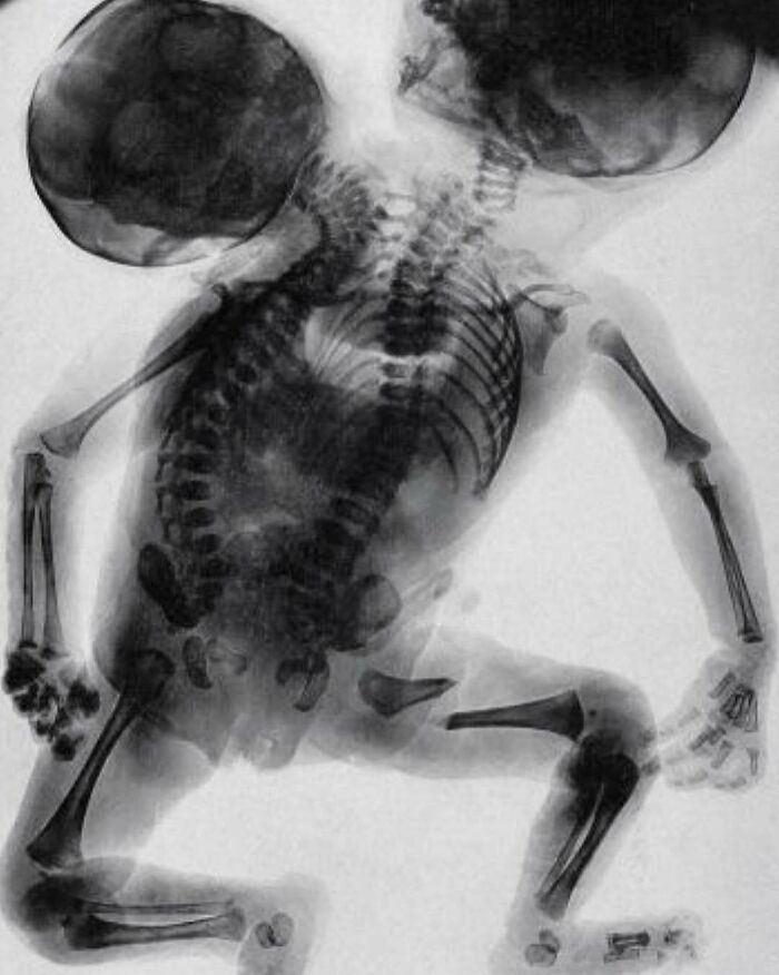 80 Fascinating And Unnerving Medical Pics You May Need A Moment To Process