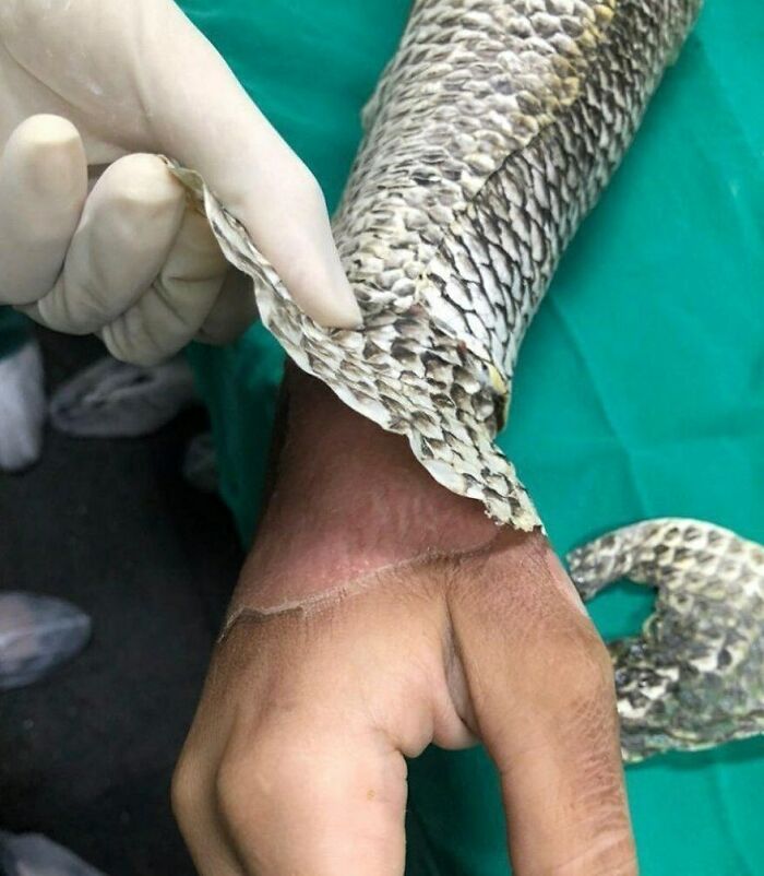 80 Fascinating And Unnerving Medical Pics You May Need A Moment To Process