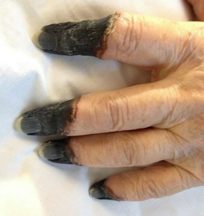 80 Fascinating And Unnerving Medical Pics You May Need A Moment To Process