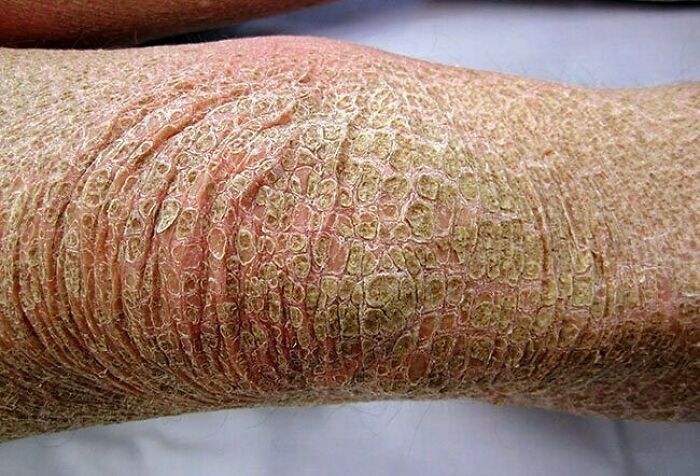 80 Fascinating And Unnerving Medical Pics You May Need A Moment To Process