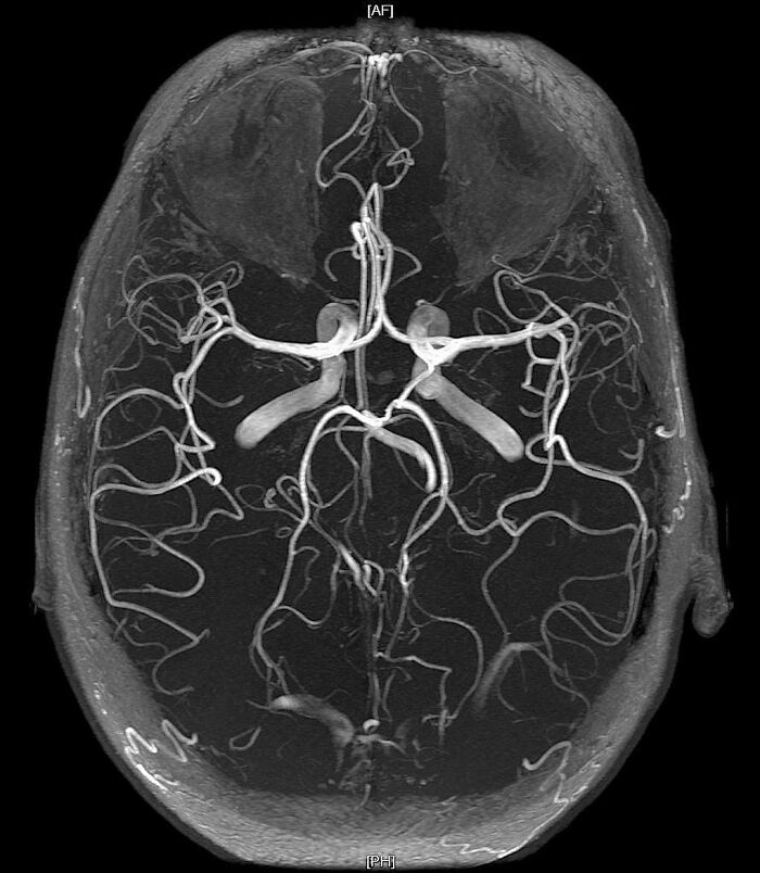 80 Fascinating And Unnerving Medical Pics You May Need A Moment To Process