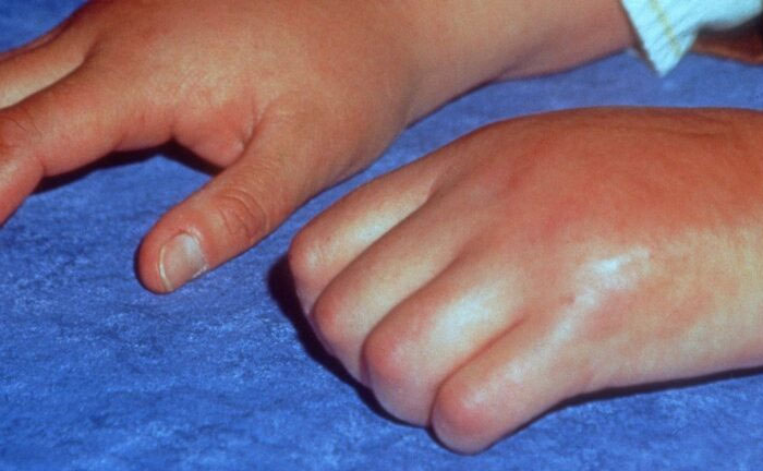 &ldquo;Can&rsquo;t Be Cured&rdquo;: 38 Absolutely Heartbreaking Medical Conditions That No Person Deserves To Have