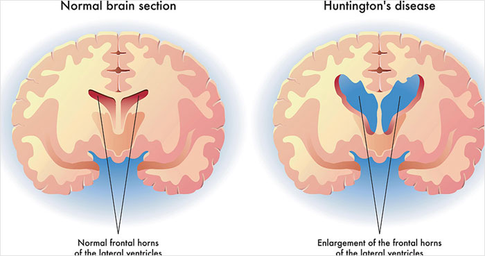 &ldquo;Can&rsquo;t Be Cured&rdquo;: 38 Absolutely Heartbreaking Medical Conditions That No Person Deserves To Have