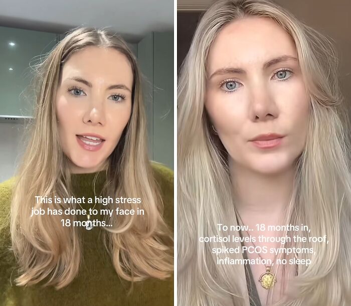 67 People Get Vulnerable By Sharing How They&rsquo;ve Glowed Down Since They &lsquo;Peaked&rsquo;