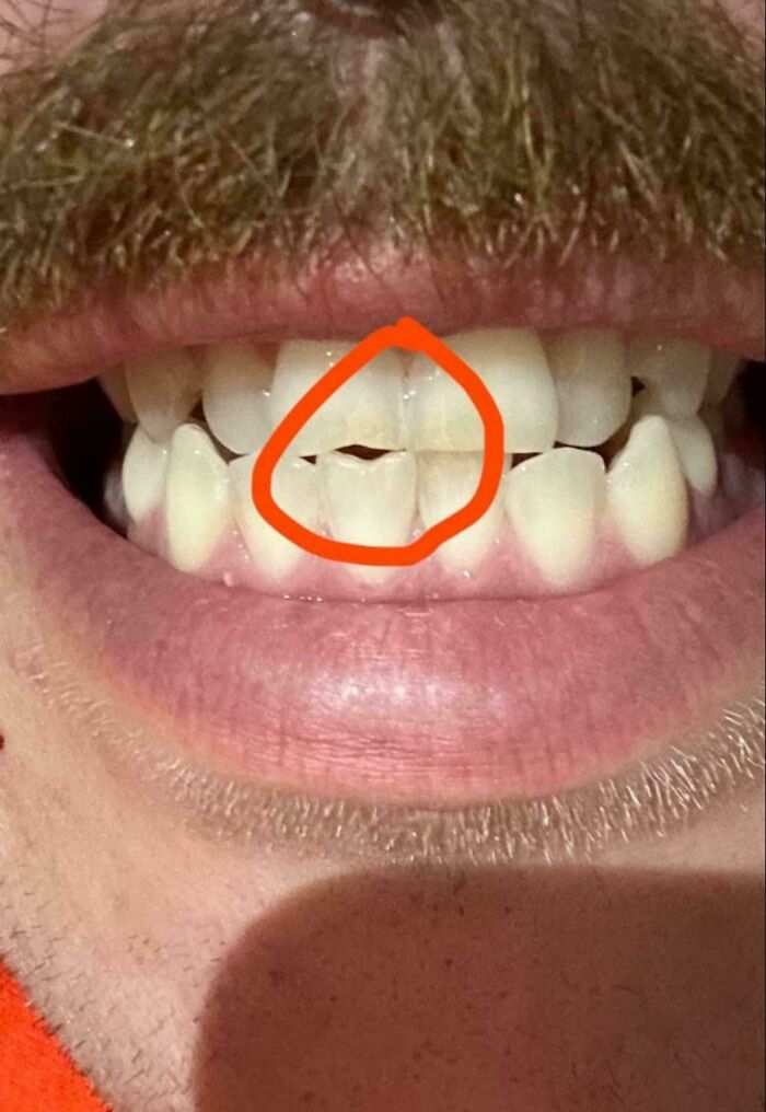 65 Fascinating Photos Of Everyday Objects That Have Worn Down In Unexpected Ways