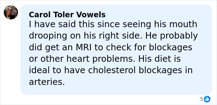 “That’s Why His Face Is Droopy”: Trump Tries To Shut Down Health Speculation As Doctor Raises Concerns