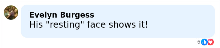 “That’s Why His Face Is Droopy”: Trump Tries To Shut Down Health Speculation As Doctor Raises Concerns