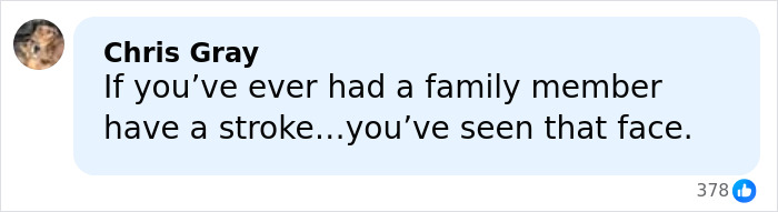 “That’s Why His Face Is Droopy”: Trump Tries To Shut Down Health Speculation As Doctor Raises Concerns