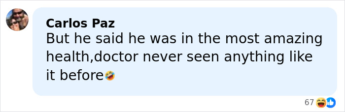 “That’s Why His Face Is Droopy”: Trump Tries To Shut Down Health Speculation As Doctor Raises Concerns