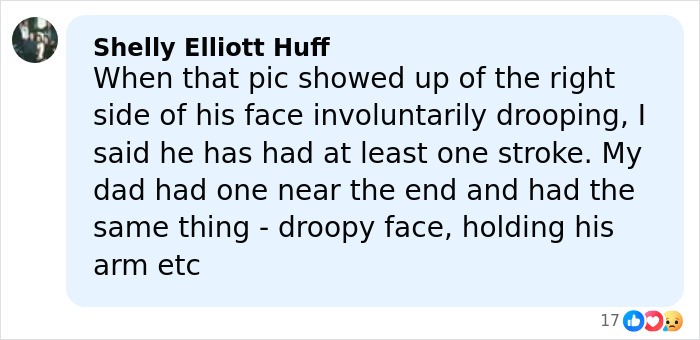 “That’s Why His Face Is Droopy”: Trump Tries To Shut Down Health Speculation As Doctor Raises Concerns