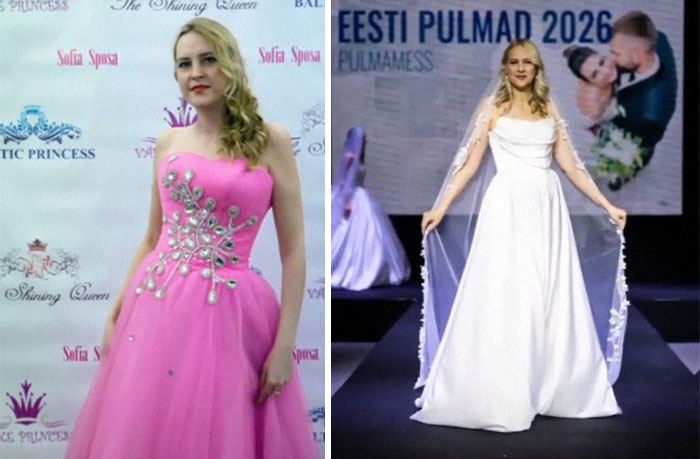 65 People Shared 2016 Vs. 2026 Photos, And Some Of Them Are Hard To Recognize