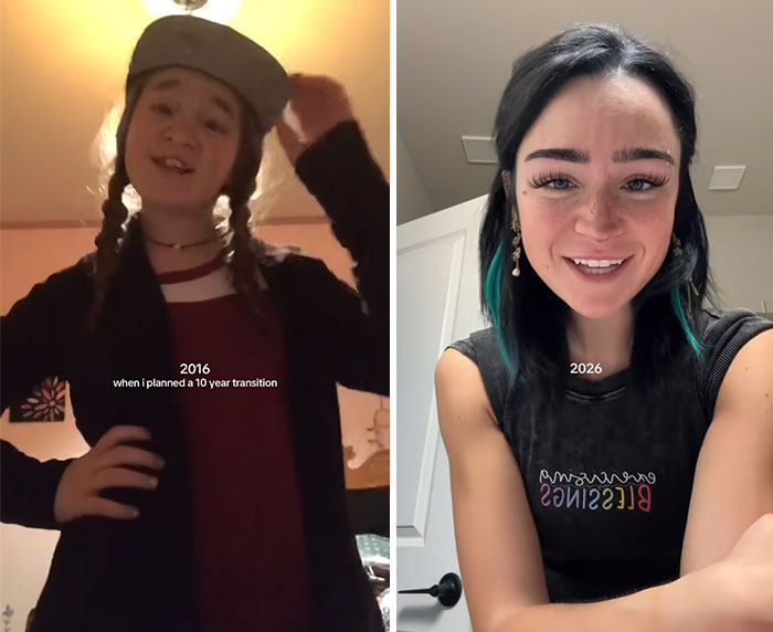 65 People Shared 2016 Vs. 2026 Photos, And Some Of Them Are Hard To Recognize