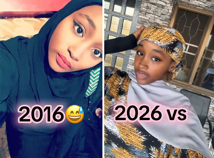 65 People Shared 2016 Vs. 2026 Photos, And Some Of Them Are Hard To Recognize