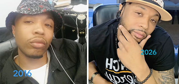 65 People Shared 2016 Vs. 2026 Photos, And Some Of Them Are Hard To Recognize